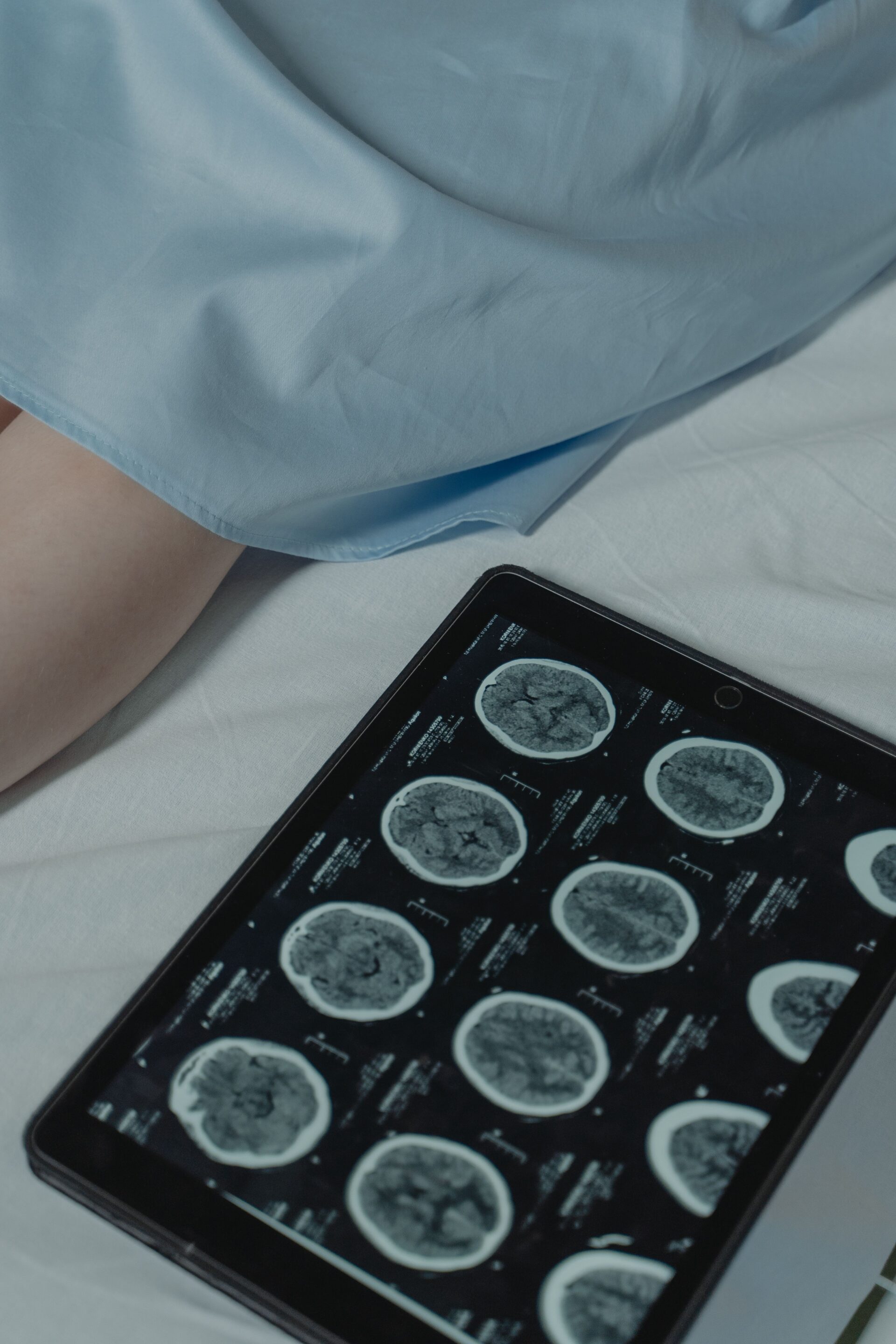 MR, Tomografi ve Ultrason Arasındaki Fark Nedir?